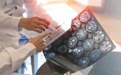 What is Pierre Marie's Hereditary Cerebellar Ataxia
