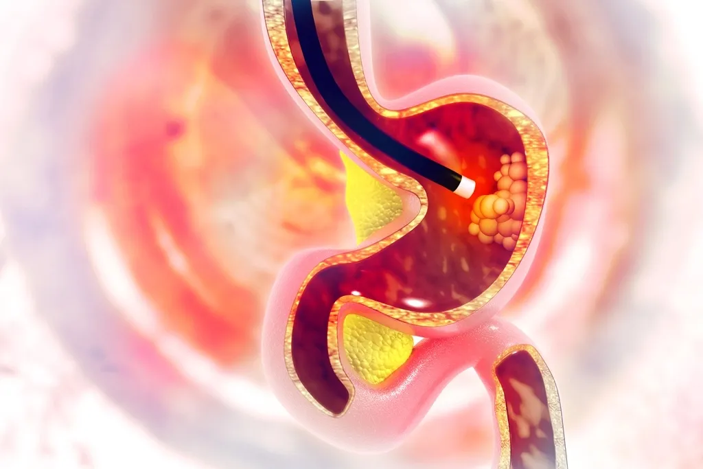 Fibrogastroduodenoscopy for children: useful information for parents