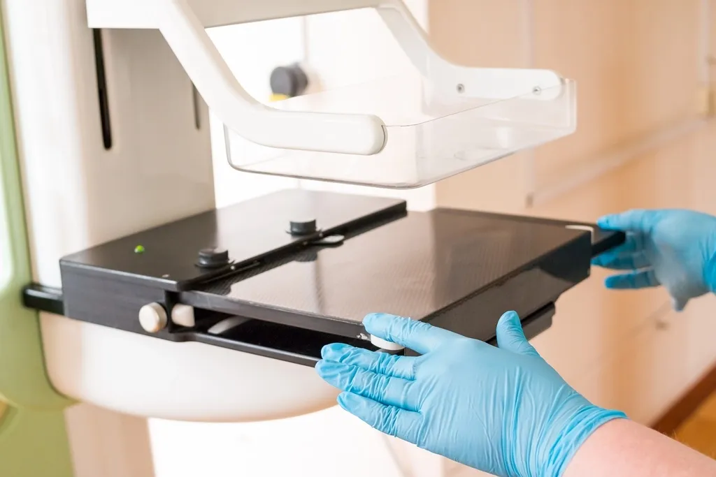 Mammography of the mammary glands