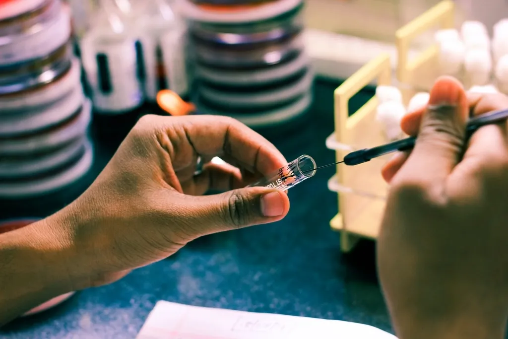 Bacteriological culture, its significance. How to properly do bakposev