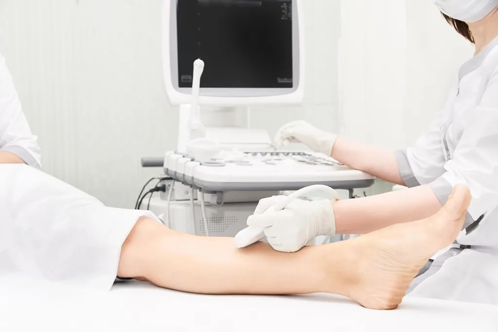Features of performing standard operations for varicose veins