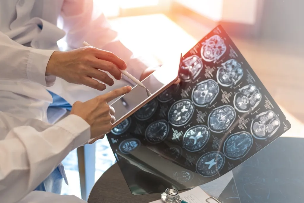 Symptoms of multiple sclerosis in women and men - what is the difference in clinical manifestations