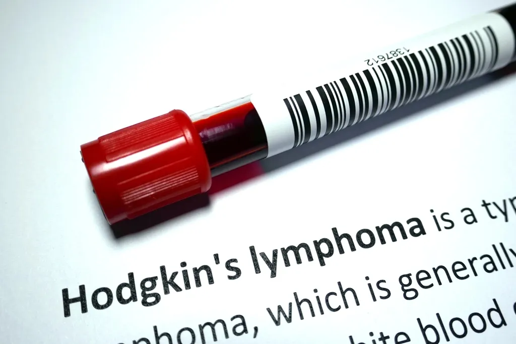 Hodgkin's disease