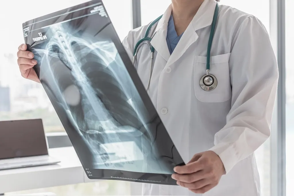 Forms and symptoms of tuberculosis in adults and children. Treatment, prevention