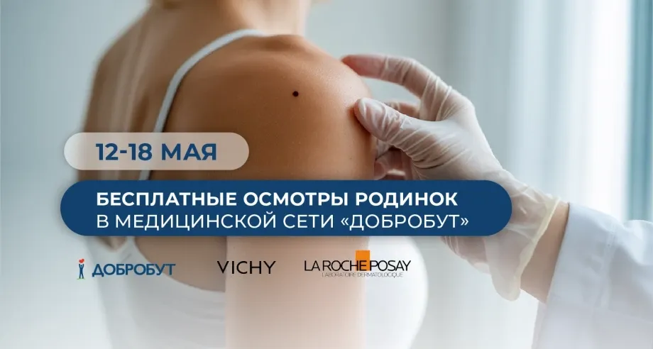 «Добробут» проведет бесплатный осмотр родинок ко Дню меланомы