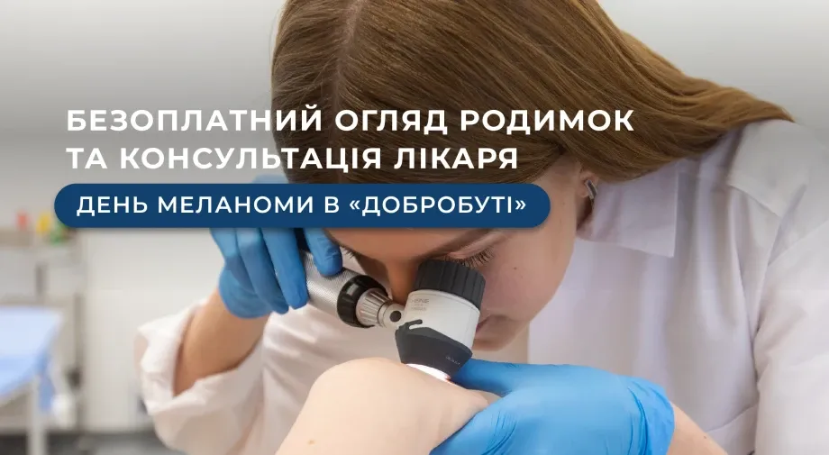 Безоплатний огляд родимок та консультація лікаря: День меланоми в «Добробуті»